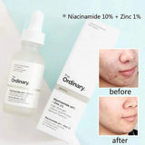 The Ordinary Niacinamide 10%+Zinc1%